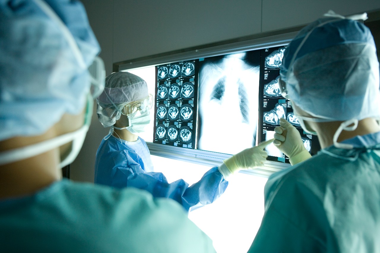 Surgeons pointing at x-ray